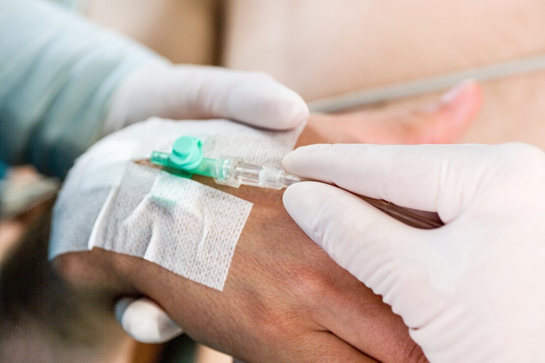 Intravenous infusion at the hand